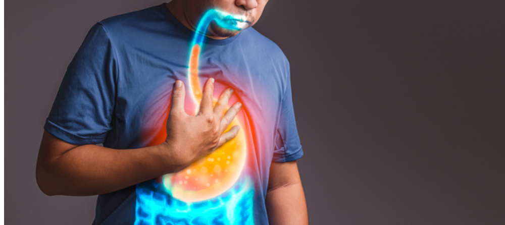 gastroesophageal reflux