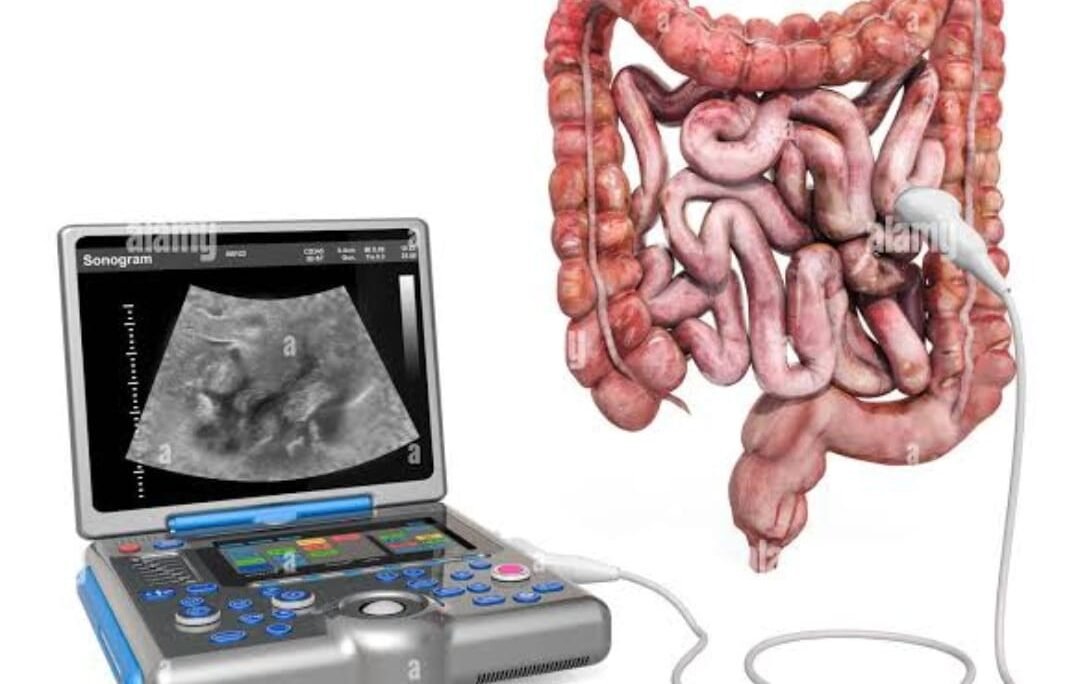 Bowel Ultrasound سونار الأمعاء