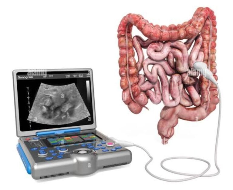 Bowel Ultrasound سونار الأمعاء