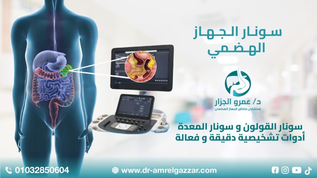 سونار الجهاز الهضمي : سونار المعدة و سونار القولون