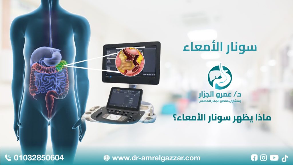 ماذا يظهر سونار الأمعاء؟