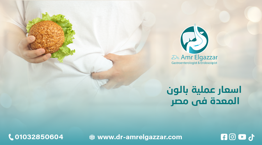 اسعار عملية بالون المعدة فى مصر