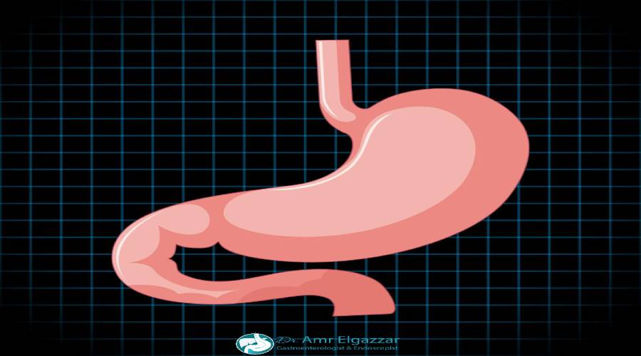 اسعار عملية بالون المعدة فى مصر 