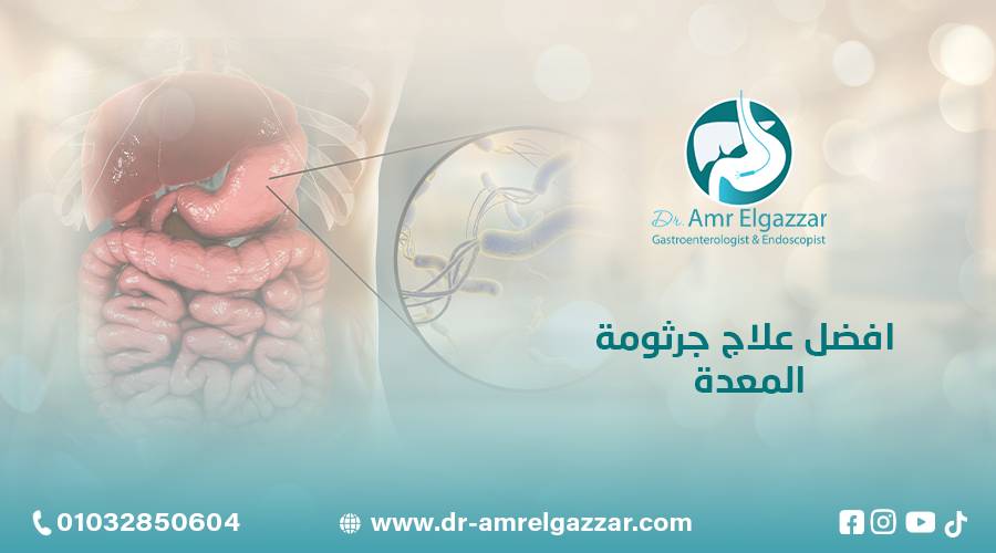 افضل علاج جرثومة المعدة