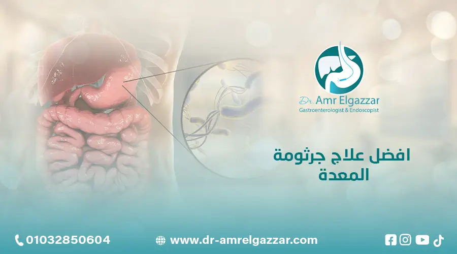 افضل علاج جرثومة المعدة