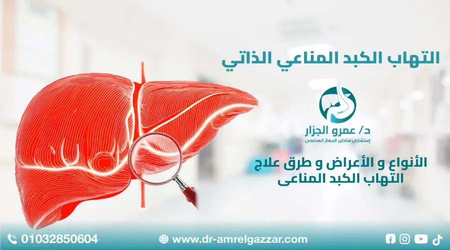 التهاب الكبد المناعي الذاتي