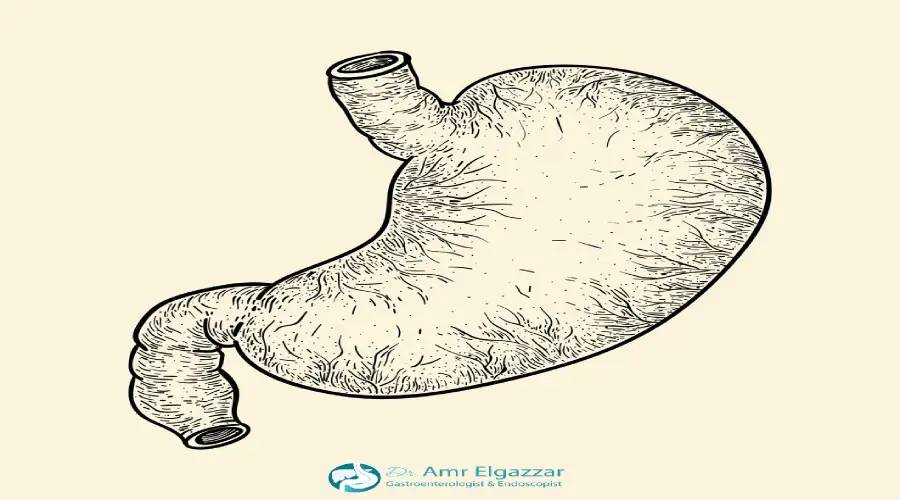 مميزات وعيوب بالون المعدة 