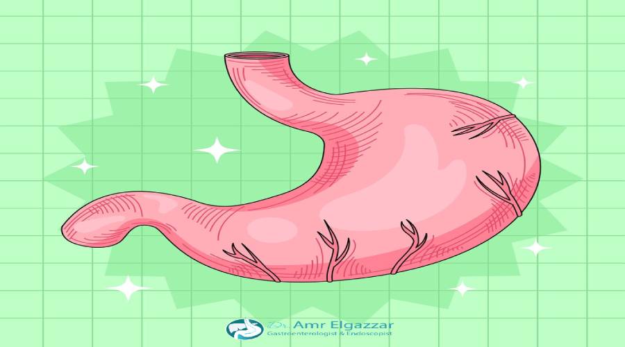 مميزات وعيوب بالون المعدة 