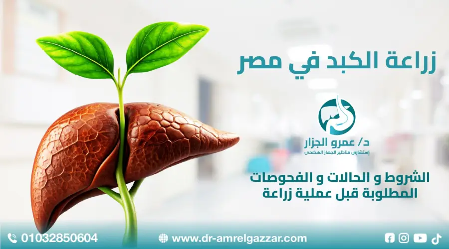 زراعة الكبد في مصر