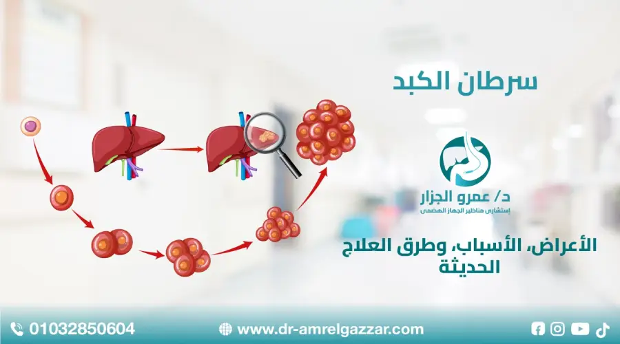 سرطان الكبد: الأعراض، الأسباب، وطرق العلاج الحديثة