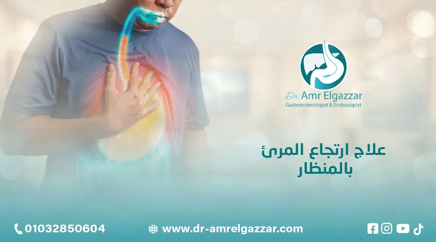 علاج ارتجاع المرئ بالمنظار
