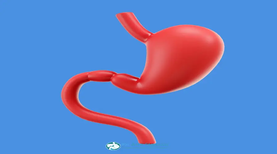 علاج ارتجاع المرئ بالمنظار