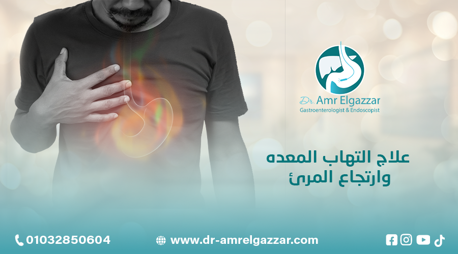 علاج التهاب المعده وارتجاع المرئ