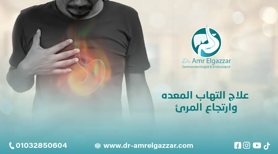 علاج التهاب المعده وارتجاع المرئ