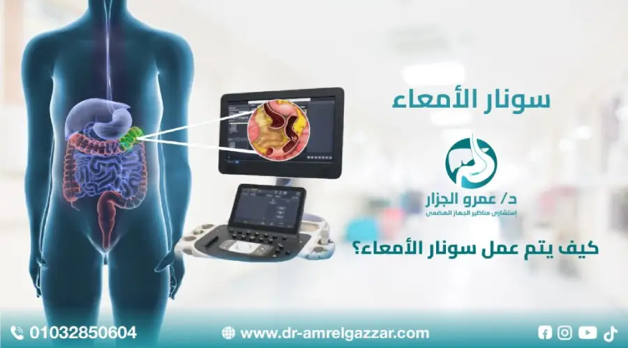 كيف يتم عمل سونار الأمعاء؟