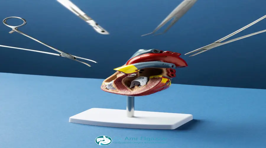 سعر منظار القولون في مصر