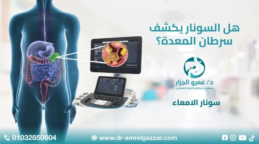 هل السونار يكشف سرطان المعدة؟