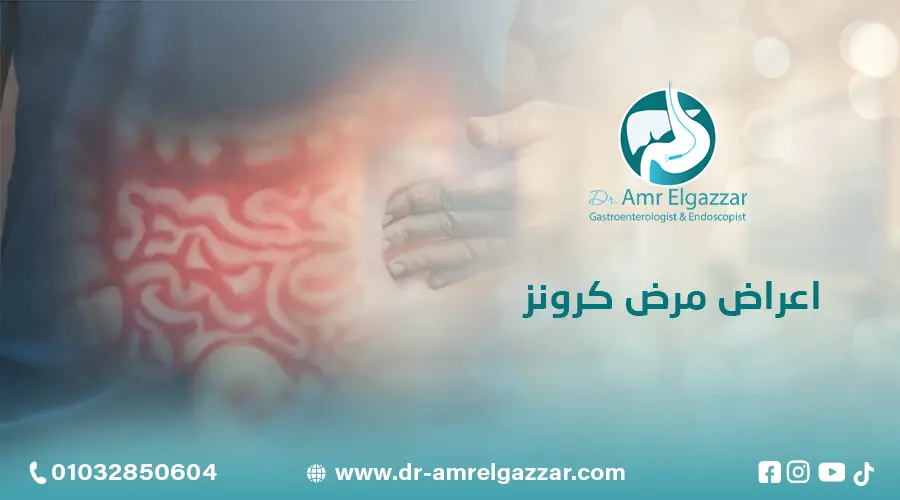 اعراض مرض كرونز