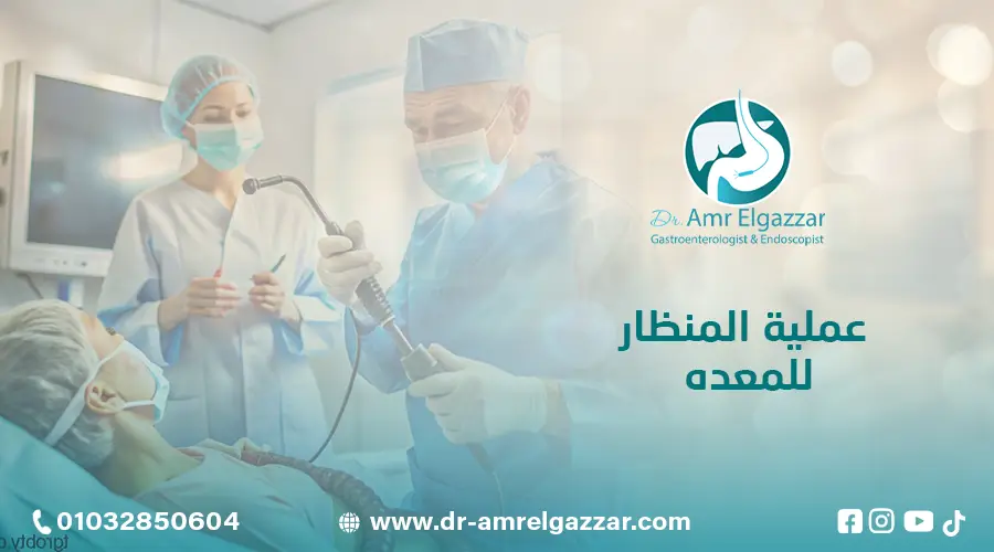 عملية المنظار للمعده