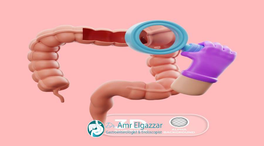 منظار على المرئ