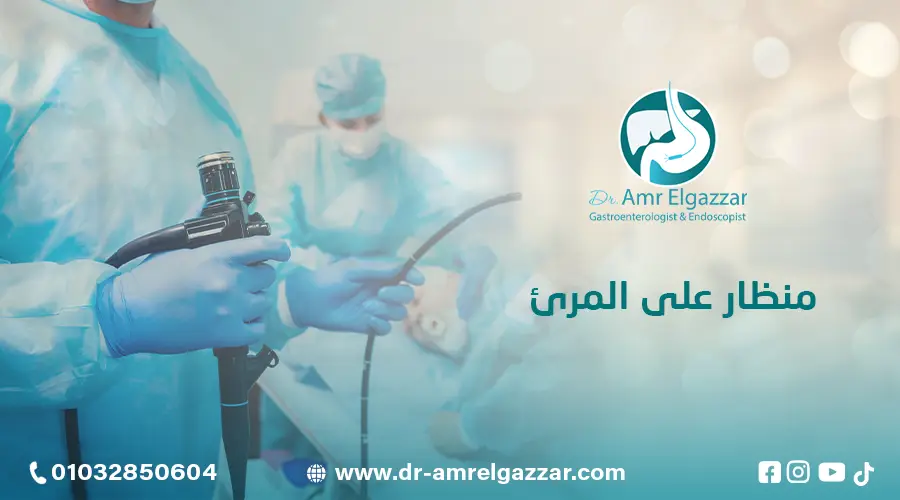 منظار على المرئ